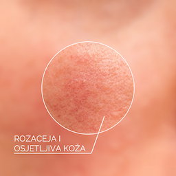 Rozaceja