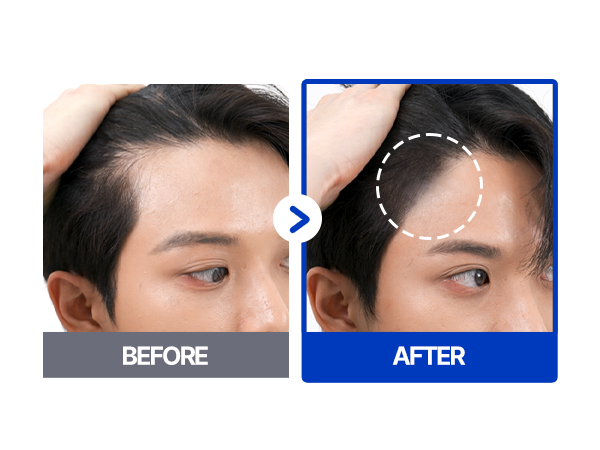 For Beaut Scalp Tattoo Black