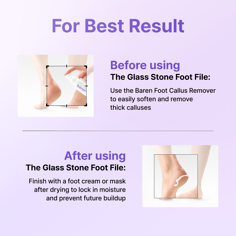 Baren Magicglass Stone Foot File