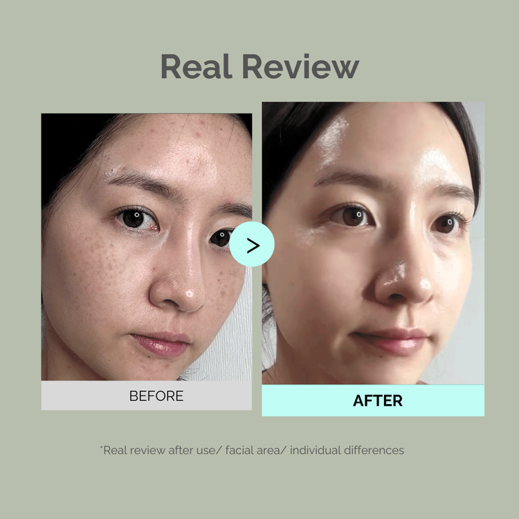 Moomy Care Perilla  Cream Plus 50g