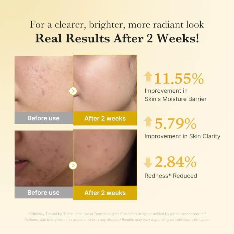 Medicube Kojic Turmeric Niacinamide Serum 30ml