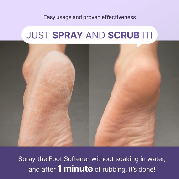 Baren Callus Remover Kit For Feet: Foot File & Peeling Foot Spray