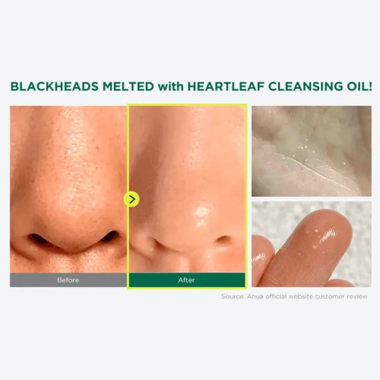 Anua Heartleaf 77% Pore Control Cleansing Oil 20ml