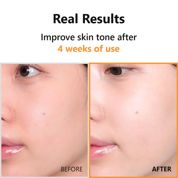 Instree Hyper C 23 Serum_20ml