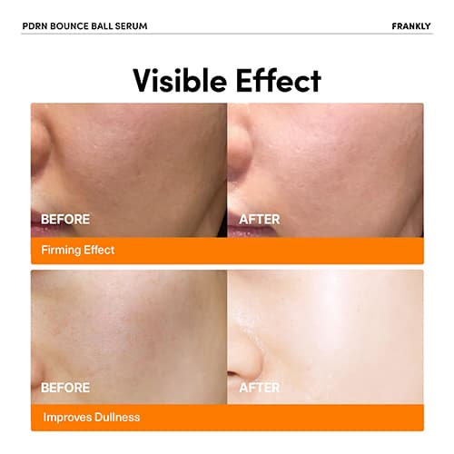 Frankly Pdrn Bounce Ball Serum 30ml