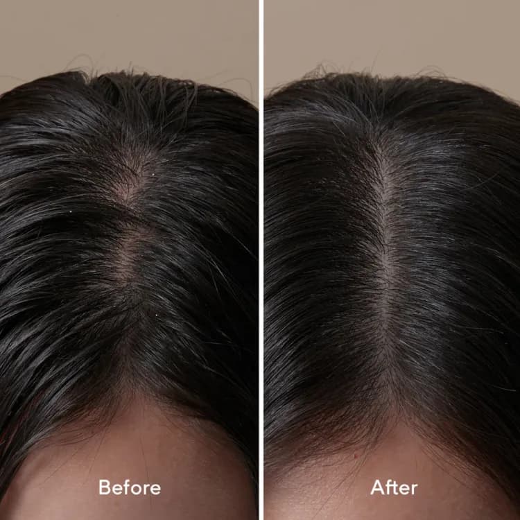 Aromatica Rosemary Active V Anti-hair Loss Tonic 100ml